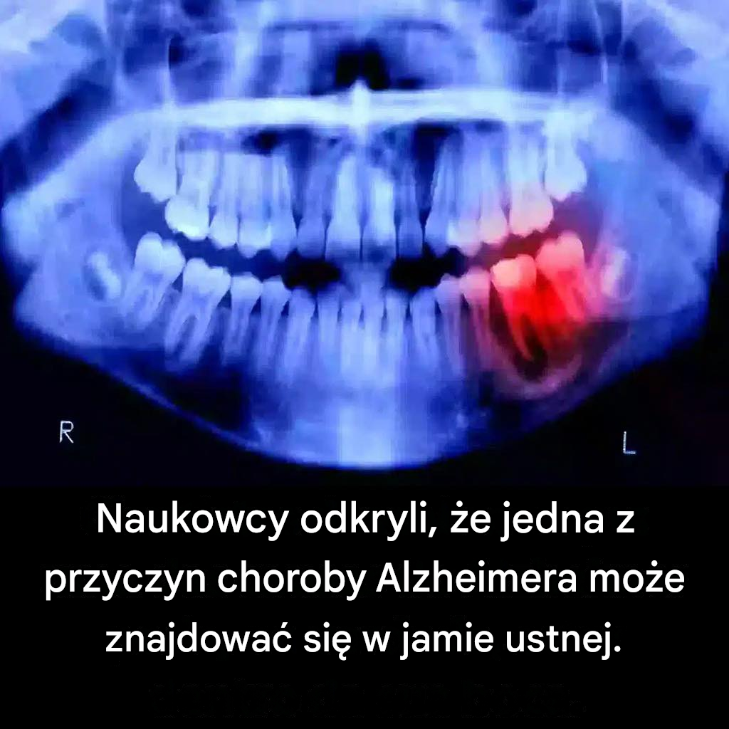 Naukowcy odkryli, że jedna z przyczyn choroby