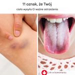 11 sygnałów, że Twoje ciało wysyła Ci ważne ostrzeżenia