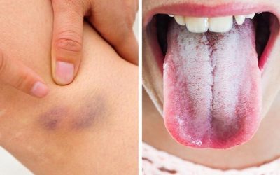 11 sygnałów, że Twoje ciało wysyła Ci ważne ostrzeżenia