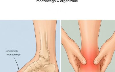 8 produktów spożywczych obniżających poziom kwasu moczowego