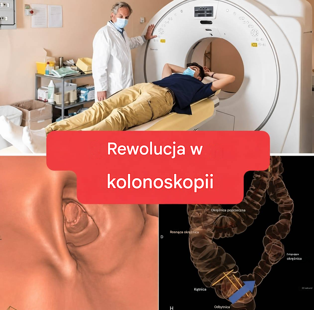 Nowa metoda: Kolonoskopia nie będzie już badaniem inwazyjnym. (1/2)